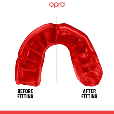 Opro Gold Level Black Jawz Mouthguard