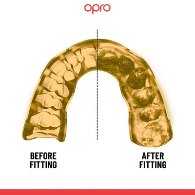 Opro Instant Custom Dentist Fit Mouthguard Navy/goud