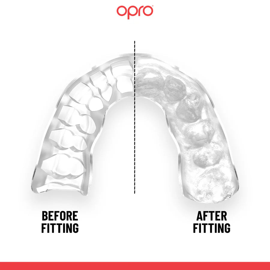 Opro Instant Custom Dentist Fit Mouthguard Clear