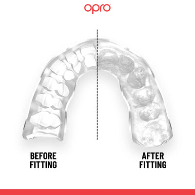 Opro Instant Custom Dentist Fit Mouthguard Clear