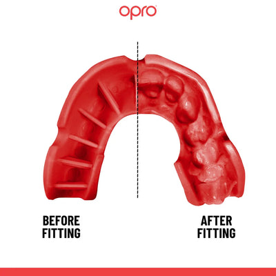 Opro Silver Fit Gebitsbeschermer